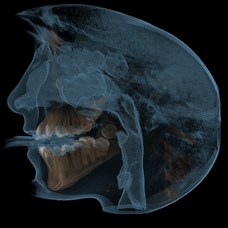 View of Airway